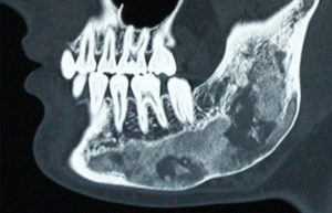 Oral Pathology Brisbane